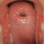 age-45-day-19wv-150x150